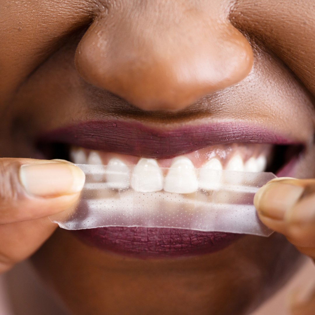 Two's Company PAP-X™ Advanced Teeth Whitening Strips Bundle